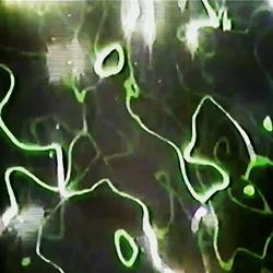 Distorted Image. Chapters from the beginnings of video art